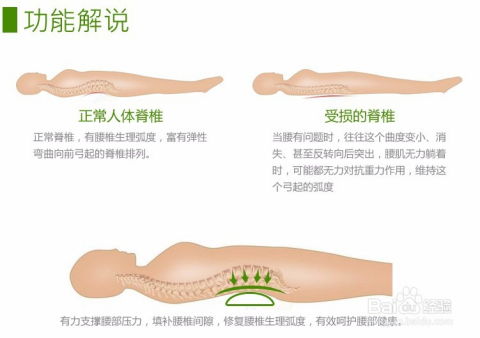 腰椎间盘突出的症状与自我诊断方法