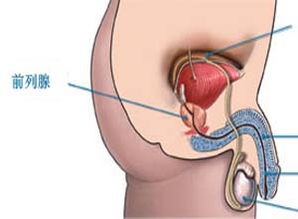 前列腺炎的自我检测与康复指南