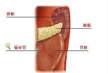 尿结石治疗全解析，从症状识别到康复护理