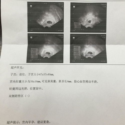 怀孕十天能否检测出来——早期妊娠检测全解析