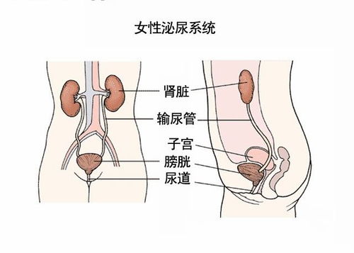 尿路感染症状全解析，如何辨别与应对