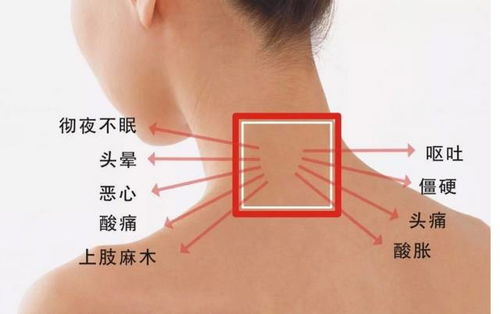 如何有效缓解颈椎疼痛？——科学指南与实用技巧